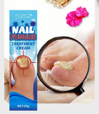Nail Fungus Treatment Cream