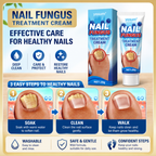 Nail Fungus Treatment Cream